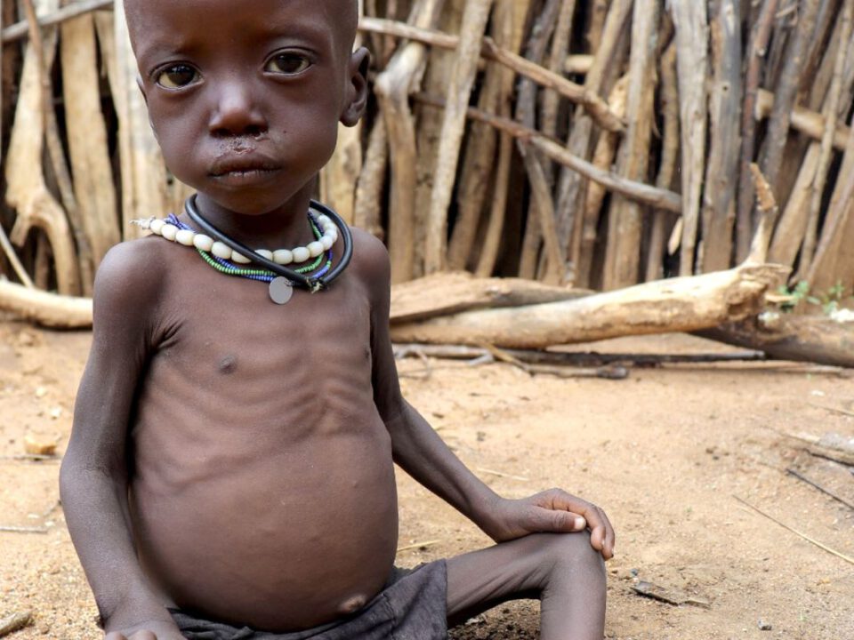 helfende hände - Ein kleines Kind mit sichtbar aufgeblähtem Bauch und dünnen Armen sitzt draußen auf dem Boden und trägt Halsketten. Im Hintergrund sind Holzstöcke und Baumstämme zu sehen. Das Kind wirkt unterernährt. helfende hände ggmbh hamburg