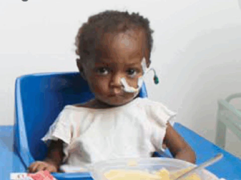 helfende hände - A young child with a nasal feeding tube sits in a blue chair, wearing a hospital gown. A plastic container with food and a spoon is on the tray in front of them. The background is plain and white. helfende hände ggmbh hamburg